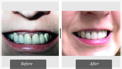 Dentist Wichita - Smile gallery image 1