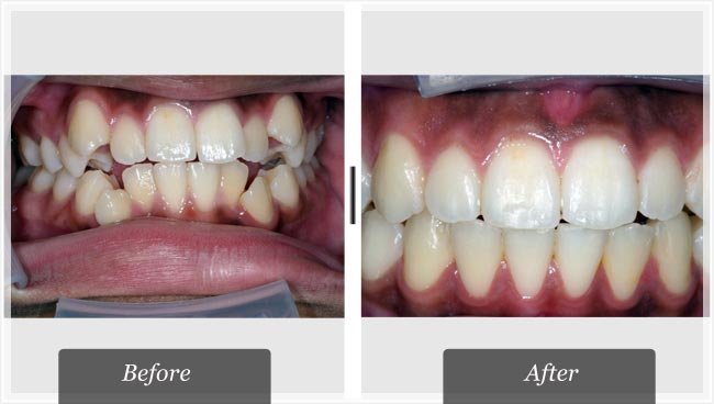 Sam Whittle Orthodontist